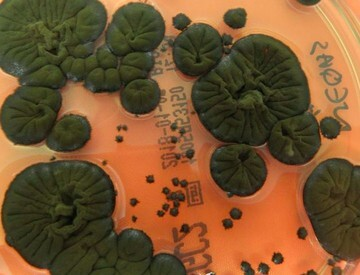 Sensasi Chernobyl! Jamur Hitam Ini Tak Hanya Kebal, Tapi ‘Santap’ Radiasi Sebagai Energi!